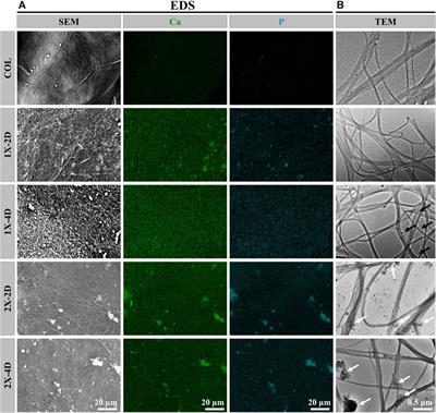 A variable mineralization time and solution concentration intervene in the microstructure of biomimetic mineralized collagen and potential osteogenic microenvironment